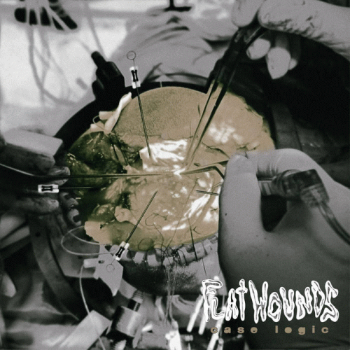 Flatwounds : Case Logic